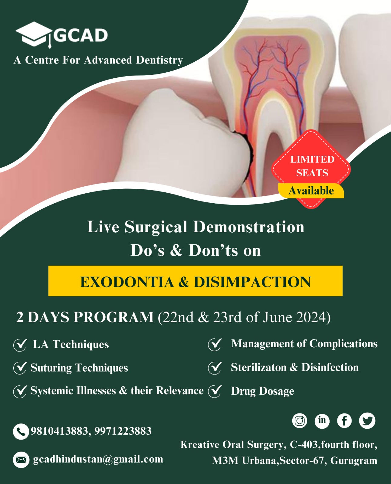 Live Surgical Demonstration Do’s & Don’ts on – Exodontia & Disimpaction